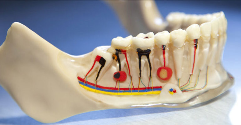 Root Canal Extractions - Holistic Biological Dentistry | Dr. Jesús